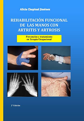 Rehabilitación funcional de las manos con artritis y artrosis: Prevención y tratamiento